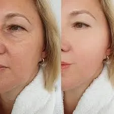 Precisión e innovación en estética avanzada: tecnología que define el futuro del tratamiento facial